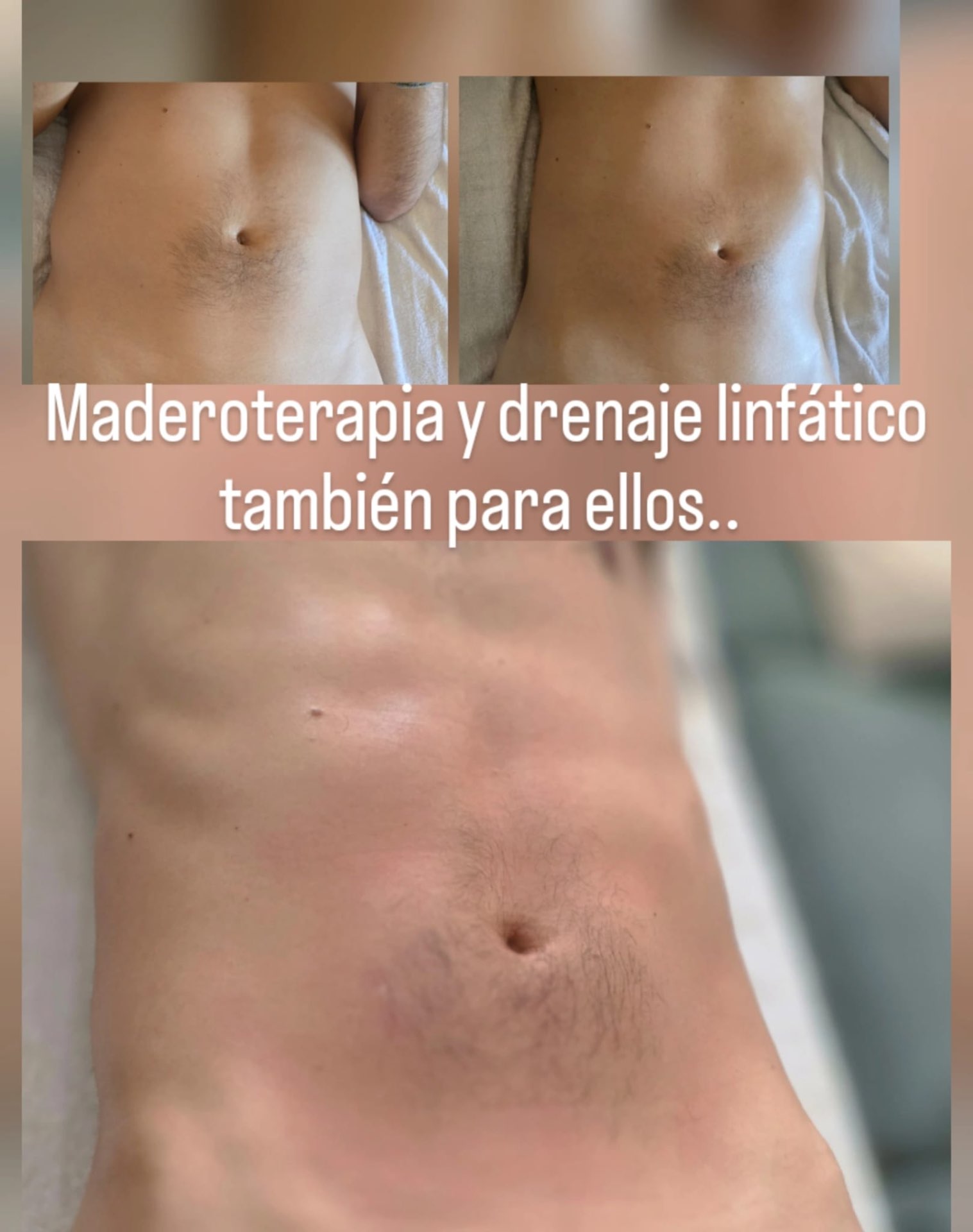 Maderoterapia y moldeo